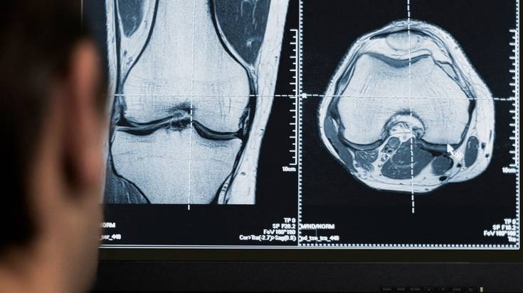 Belaun baten ibili herrenak