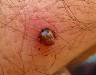 Sukar hemorragikoaren birusa daramaten kaparren izurritea dagoela ohartarazi dute Trebiñun