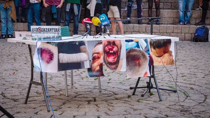 Ibarrak jasotako pilotakada ikertzen hasi da Ertzaintza